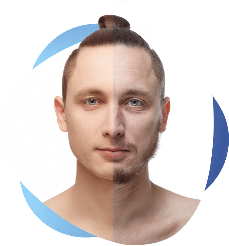 Expert Hair Loss Treatment & Transplant clinic in Trivandrum